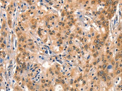 AIMP1 Polyclonal Antibody Store at -20°C Host Rabbit