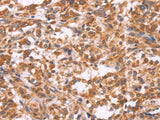 EMP2 Polyclonal Antibody