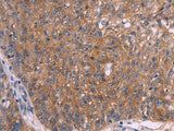 EMP2 Polyclonal Antibody
