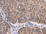 Ephrin A5 Polyclonal Antibody