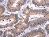 Ephrin A5 Polyclonal Antibody