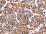 MSMO1 Polyclonal Antibody