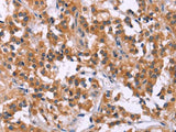 MSMO1 Polyclonal Antibody