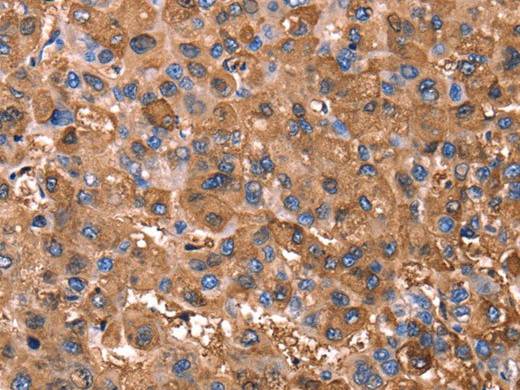 ERN2 Polyclonal Antibody