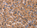 ERN2 Polyclonal Antibody