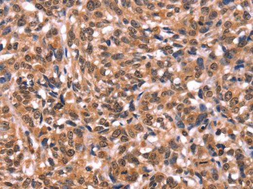 ESRRB Polyclonal Antibody Store at -20°C Host Rabbit