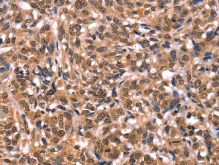 ESRRB Polyclonal Antibody Store at -20°C Host Rabbit