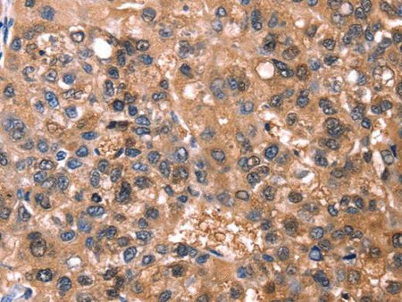 ESRRB Polyclonal Antibody Store at -20°C Host Rabbit
