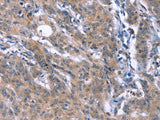 ESPL1 Polyclonal Antibody