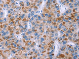 ESPL1 Polyclonal Antibody