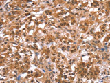 AMER1 Polyclonal Antibody