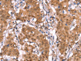 AMER1 Polyclonal Antibody
