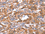FAM13B Polyclonal Antibody