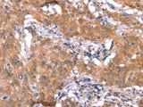 FAM13B Polyclonal Antibody