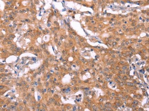 FBXO31 Polyclonal Antibody Store at -20°C Host Rabbit