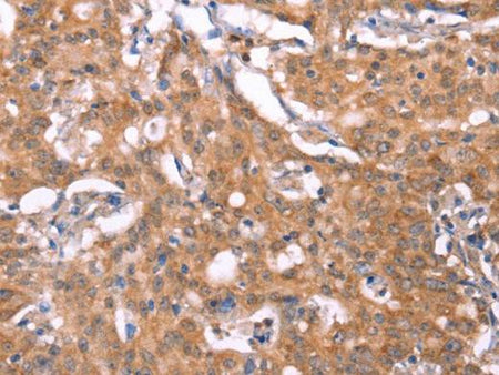 FBXO31 Polyclonal Antibody Store at -20°C Host Rabbit