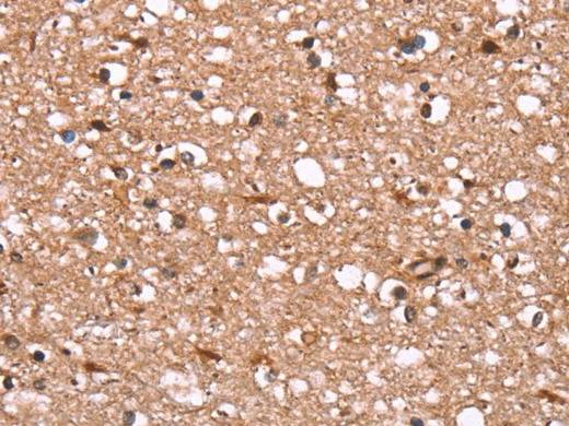 FBXO31 Polyclonal Antibody Store at -20°C Host Rabbit