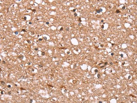 FBXO31 Polyclonal Antibody Store at -20°C Host Rabbit