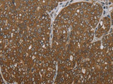 FOLH1B Polyclonal Antibody