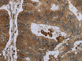 FOLH1B Polyclonal Antibody