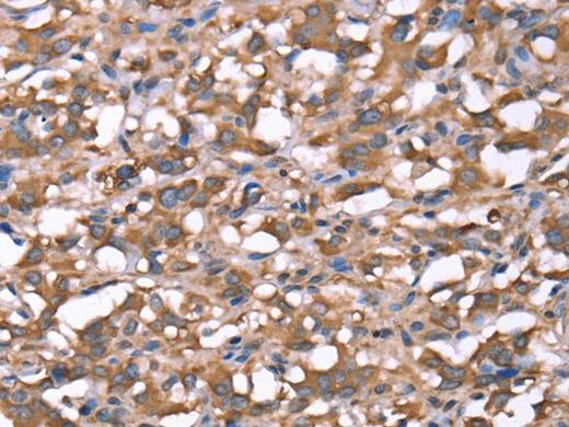 SPAST Polyclonal Antibody Store at -20°C