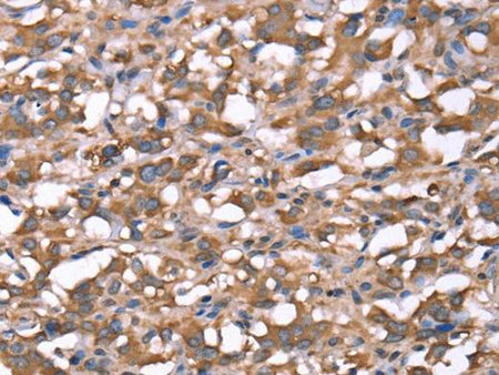 SPAST Polyclonal Antibody Store at -20°C