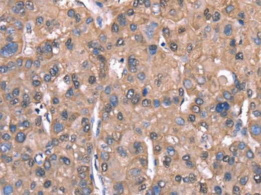 SPAST Polyclonal Antibody Store at -20°C