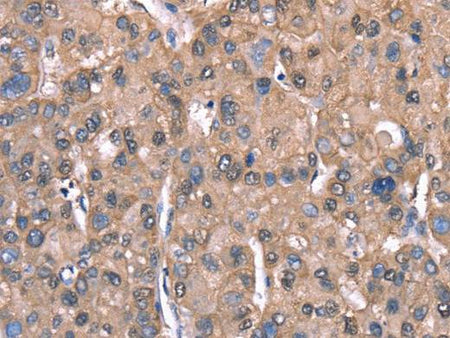 SPAST Polyclonal Antibody Store at -20°C
