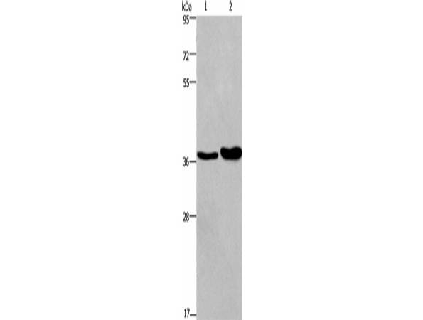 FUT1 Polyclonal Antibody Store at -20°C