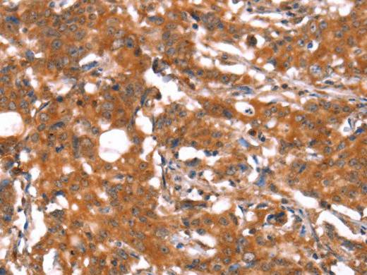 FUT1 Polyclonal Antibody Store at -20°C