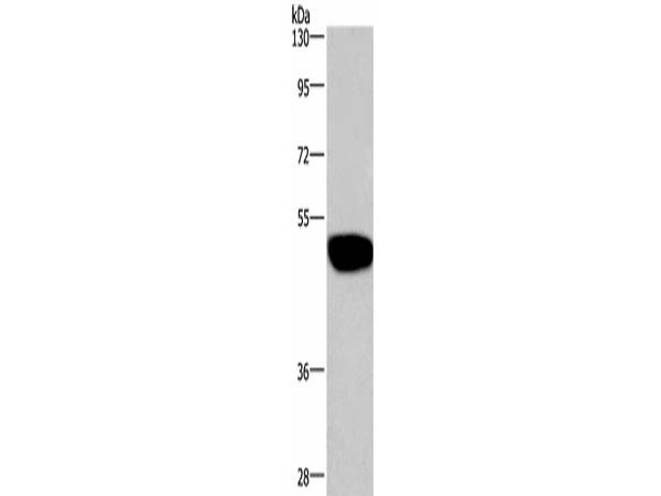 GABAA Receptor alpha1 Polyclonal Antibody Store at -20°C