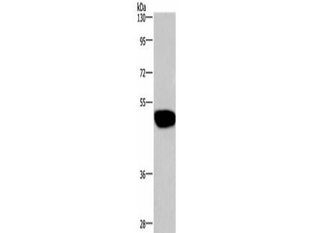 GABAA Receptor alpha1 Polyclonal Antibody Store at -20°C