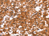 GABAA Receptor alpha1 Polyclonal Antibody Store at -20°C
