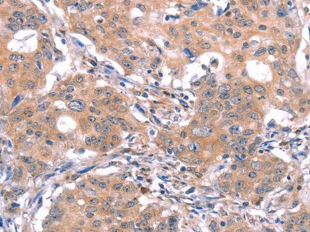 GABAA Receptor alpha1 Polyclonal Antibody Store at -20°C