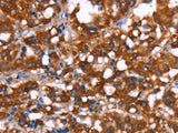 GAGE12I Polyclonal Antibody