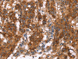 GAGE12I Polyclonal Antibody