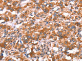 GAS8 Polyclonal Antibody