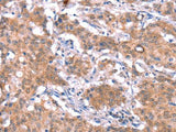 GAS8 Polyclonal Antibody