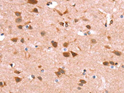 GH1 Polyclonal Antibody Store at -20°C