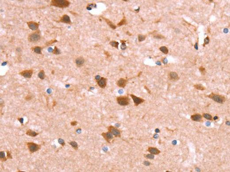GH1 Polyclonal Antibody Store at -20°C