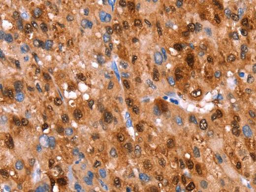 GH1 Polyclonal Antibody Store at -20°C