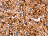 GH1 Polyclonal Antibody Store at -20°C
