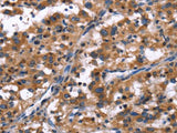 R3HCC1L Polyclonal Antibody