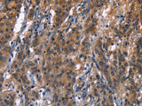 R3HCC1L Polyclonal Antibody