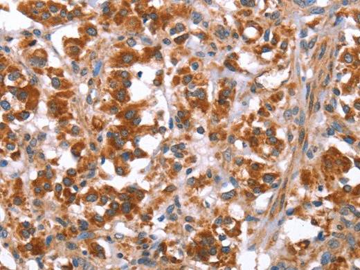 GLMN Polyclonal Antibody Store at -20°C