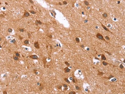 GLMN Polyclonal Antibody Store at -20°C
