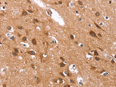 GLMN Polyclonal Antibody Store at -20°C