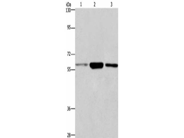 GPC6 Polyclonal Antibody Store at -20°C Host Rabbit