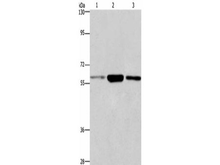 GPC6 Polyclonal Antibody Store at -20°C Host Rabbit