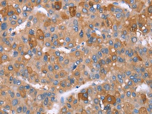 GPC6 Polyclonal Antibody Store at -20°C Host Rabbit